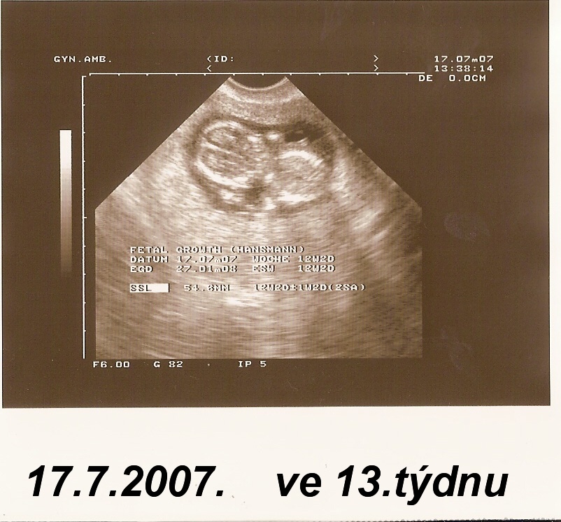 13ttult.jpg